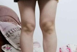 孕期腿长胖（婴儿腿一边瘦一边胖）
