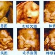 二维彩超和四维彩超区别,胎儿二维彩超检查什么