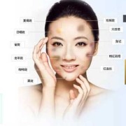 防止长斑的正确方法,怎么预防怀孕期间长斑的方法