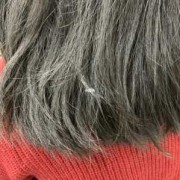 孕期不长头发（头发好象没有发根是为什么）