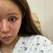 为什么孩子抱起来总张大嘴巴,胎儿张大嘴在干什么
