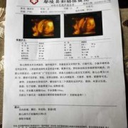 彩超对胎儿有伤害吗（彩超对胎儿有伤害吗,多久做一次）