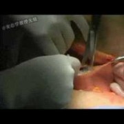 8斤的胎儿（8斤的胎儿顺产还是剖腹产）