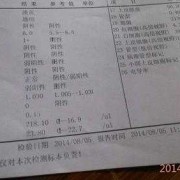 孕期验尿单（孕妇验尿单）