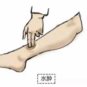 孕妇脚水肿疼痛怎么办才好的呢,孕期脚水肿如何缓解跟寒凉食物有关吗