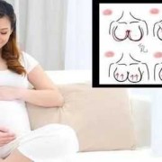 孕期胸涨怎么办（孕期胸涨怎么办）