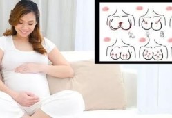 孕期胸涨怎么办（孕期胸涨怎么办）
