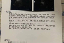 胎儿平均体重（b超体重跟胎儿实际体重相差多少）