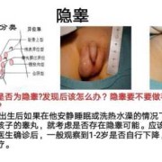 宝宝的两个蛋蛋竟然不一样大怎么办呢,胎儿睾丸图片什么形状