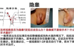 宝宝的两个蛋蛋竟然不一样大怎么办呢,胎儿睾丸图片什么形状