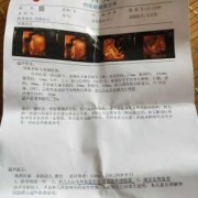 六个月胎儿四维彩超图（六个月胎儿四维彩超图 男孩）