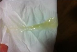 怀孕三个月有白带正常吗？一天还挺多,孕妇分泌物多下面痒怎么办