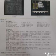 胎儿系统超声检查是什么（32周系统彩超检查什么）