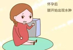 怀孕胎儿水肿有救吗（孕期胎儿水肿还能要吗）