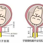 胎儿宫颈长（宫颈长度会变化吗）