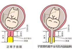 胎儿宫颈长（宫颈长度会变化吗）