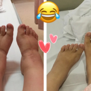 怀孕脚会变大吗为什么呢,孕期脚会变大吗?