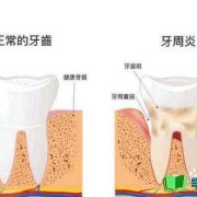 孕期有口臭（孕妇牙龈出血口臭怎么办呢）