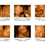 整个孕期要做几次四维彩超？一般只做1次就可以吗,怀孕期间做几次四维彩超合适
