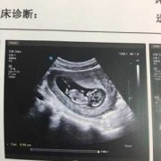 孕11周胎儿稳定了吗（我怀孕11周了，没有任何反应，这是怎么回事呢）