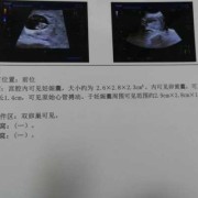 孕期照彩超（孕期照彩超多了好不好）