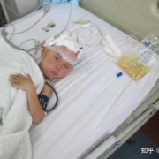 胎儿轻度脑积水怎么办（胎儿轻度脑积水怎么办呢）