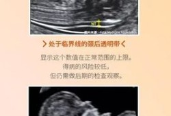 胎儿颈项透明（NT检查胎儿颈部透明层较厚约1.4mm正常吗）