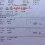 早期唐筛结果怎么看,唐氏胎儿在母体的征兆