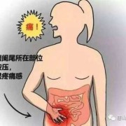 孕期阑尾炎的症状（孕期阑尾炎的症状表现有哪些症状）