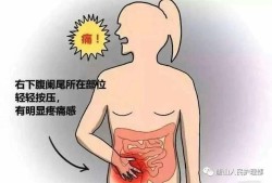 孕期阑尾炎的症状（孕期阑尾炎的症状表现有哪些症状）