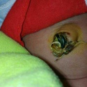 宝宝五十天了肚脐凸起来的用手按压下去感觉有水声什么回事,五十多天的胎儿图片真实