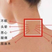 孕期颈椎病（孕期颈椎病）