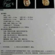做四维显示左心室有强回声,胎儿左心房有强回声点