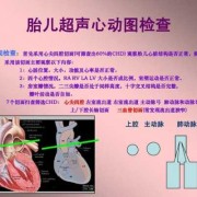 胎儿超声心动图学（胎儿超声心动图学教程）