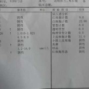 孕期验尿单（孕妇验尿单）