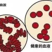 孕妇血稠对胎儿的影响（孕妇血稠对胎儿的影响）
