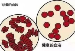 孕妇血稠对胎儿的影响（孕妇血稠对胎儿的影响）