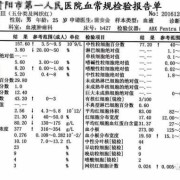 孕妇查血常规尿常规需要空腹吗,孕期尿检白细胞高说明什么问题