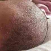 新生儿头上干干净净的，没有头痂好吗,胎儿全或无是什么意思