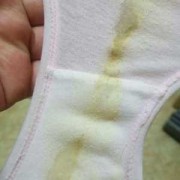 备孕期间白带发黄（孕前什么时候做白带检查最好呢）
