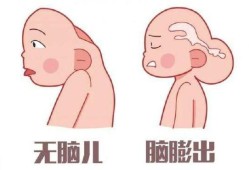 胎儿大脑受损（胎儿大脑受损）