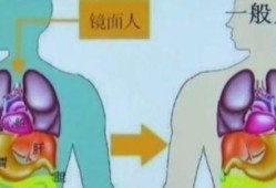 胎儿镜面人（胎儿镜面人是什么意思）