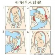 怎么让胎儿转身（怎么让胎儿转身）