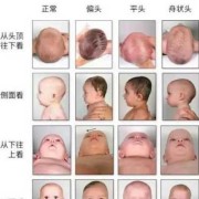 胎儿长头型正常吗（宝宝额头正常形状）