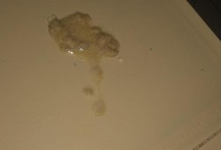 为什么,怀孕的母猫呕吐出黄色的液体,孕期吐黄水苦水是怎么回事 恶心