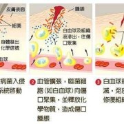 胎儿脑炎（新生儿脑炎怎么办）