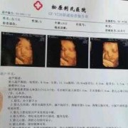 胎儿偏小四周是畸形吗（胎儿偏小四周是畸形吗）