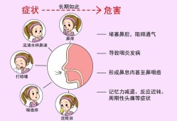 孕期有过敏性鼻炎,鼻炎影响胎儿发育吗