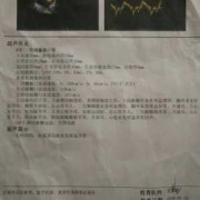 孕期心脏彩超能检查出什么（孕期心脏彩超能检查出什么毛病）