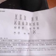 孕期染色体检查（胎儿染色体检查什么）